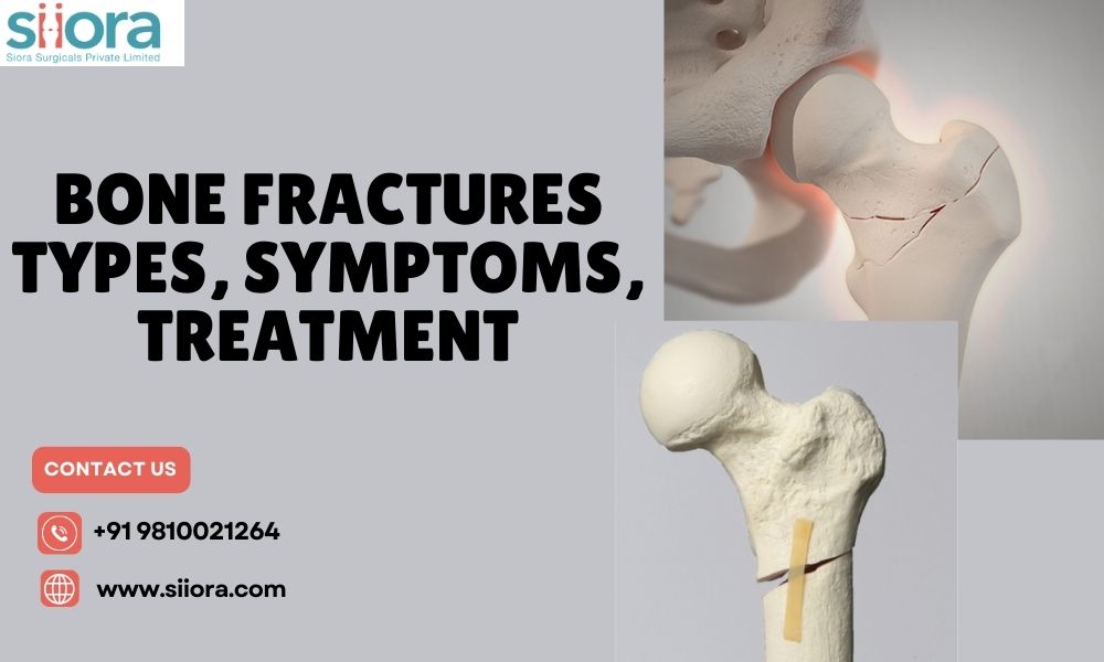 Bone Fractures