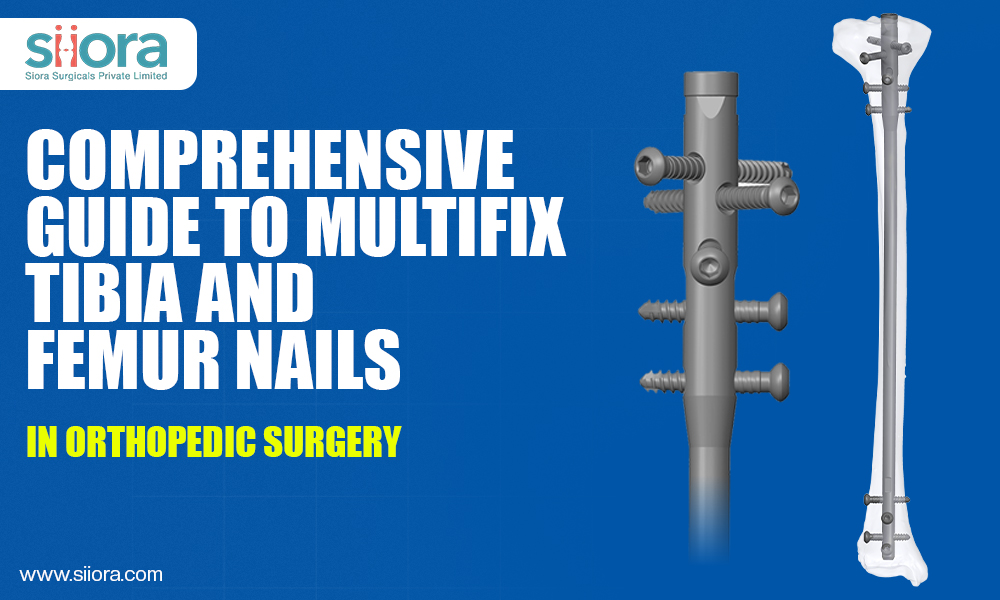 Comprehensive Guide to Multifix Tibia and Femur Nails in Orthopedic Surgery